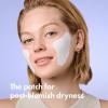 imageHERO COSMETICS Rescue Patch  The Moisturizing Cream Patch for PostBlemish Skin Provides Instant Moisture and LongLasting Hydration DermatologistTested and Wont Clog Pores 6ct 3 pairs