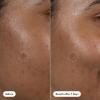 imageHero Cosmetics Dark Spot Correct SpotFading 15 Vitamin C and Hyaluronic Acid Serum Improves the Look of Post Blemish Marks in 7 Days Twist Applicator and Rollerball Tip for Easy Application 10mL