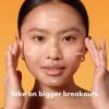 imageHero Cosmetics Mighty Patch Face Patch  XL Hydrocolloid Face Mask for Acne 5 Large Pimple Patches for Zit Breakouts on Nose Chin Forehead ampamp Cheeks 1 Count