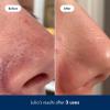 imageHero Cosmetics Pore Release Blackhead Clearing Solution  Exfoliating Toner Featuring BHA PHA AHA and 2 Salicylic Acid 100 ml338 Fl Oz Pack of 1