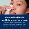 imageHero Cosmetics Pore Release Blackhead Clearing Solution  Exfoliating Toner Featuring BHA PHA AHA and 2 Salicylic Acid 100 ml338 Fl Oz Pack of 1