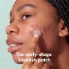 imageMighty Patch Micropoint for Blemishes from Hero Cosmetics  Hydrocolloid Acne Spot Treatment Patch for Early Stage Zits and Hidden Pimples 395 Micropoints 8 Patches8 Count Pack of 1