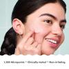imageMighty Patch Micropoint for Blemishes from Hero Cosmetics  Hydrocolloid Acne Spot Treatment Patch for Early Stage Zits and Hidden Pimples 395 Micropoints 8 Patches6 Count Pack of 1