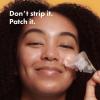 imageMighty Patches for nose pores from Hero Cosmetics  XL Hydrocolloid Pimples Zits and Oil  DermatologistApproved Overnight pore Strips to Absorb Acne nose Gunk 10 Count