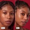 imageRescue Balm Dark Spot Retouch PostBlemish Recovery Cream from Hero Cosmetics  Nourishing and Calming After a Blemish  Corrects Discoloration  Dermatologist Tested 0507 fl oz